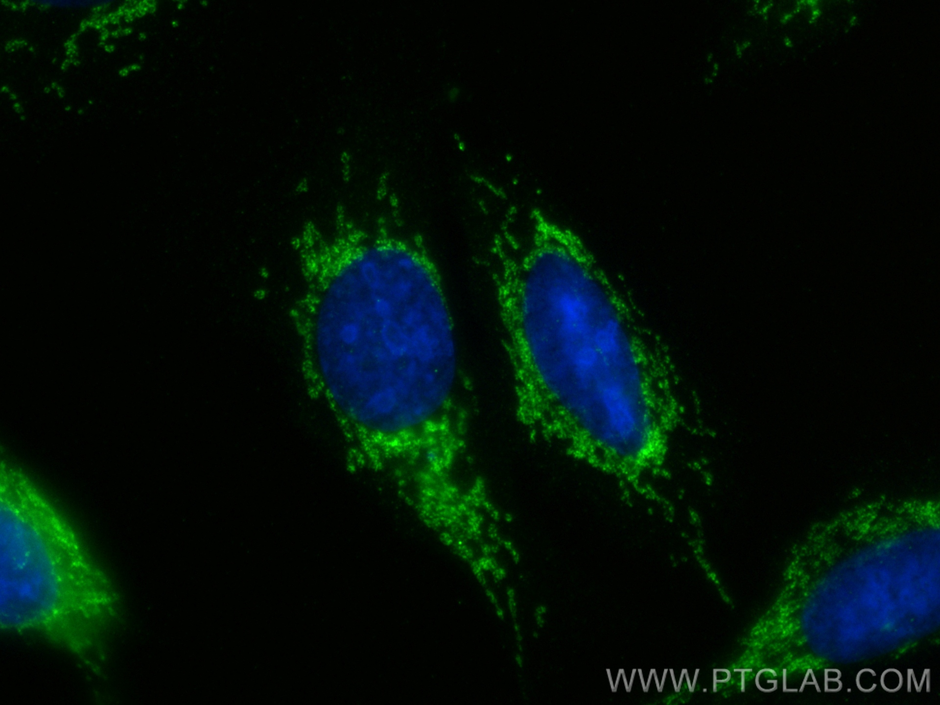 Immunofluorescent analysis of (-20°C Ethanol) fixed U2OS cells using CLPX antibody (<a class='green' href='/productredirect?CatalogNo=83097-1-RR' target='_blank'>83097-1-RR</a>, Clone: 230346H1 ) at dilution of 1:200 and CoraLite®488-Conjugated Goat Anti-Rabbit IgG(H+L) (<a class='green' href='/productredirect?CatalogNo=SA00013-2' target='_blank'>SA00013-2</a>). This data was developed using the same antibody clone with 83097-1-PBS in a different storage buffer formulation. IF Staining of U2OS using 83097-1-RR (same clone as 83097-1-PBS)