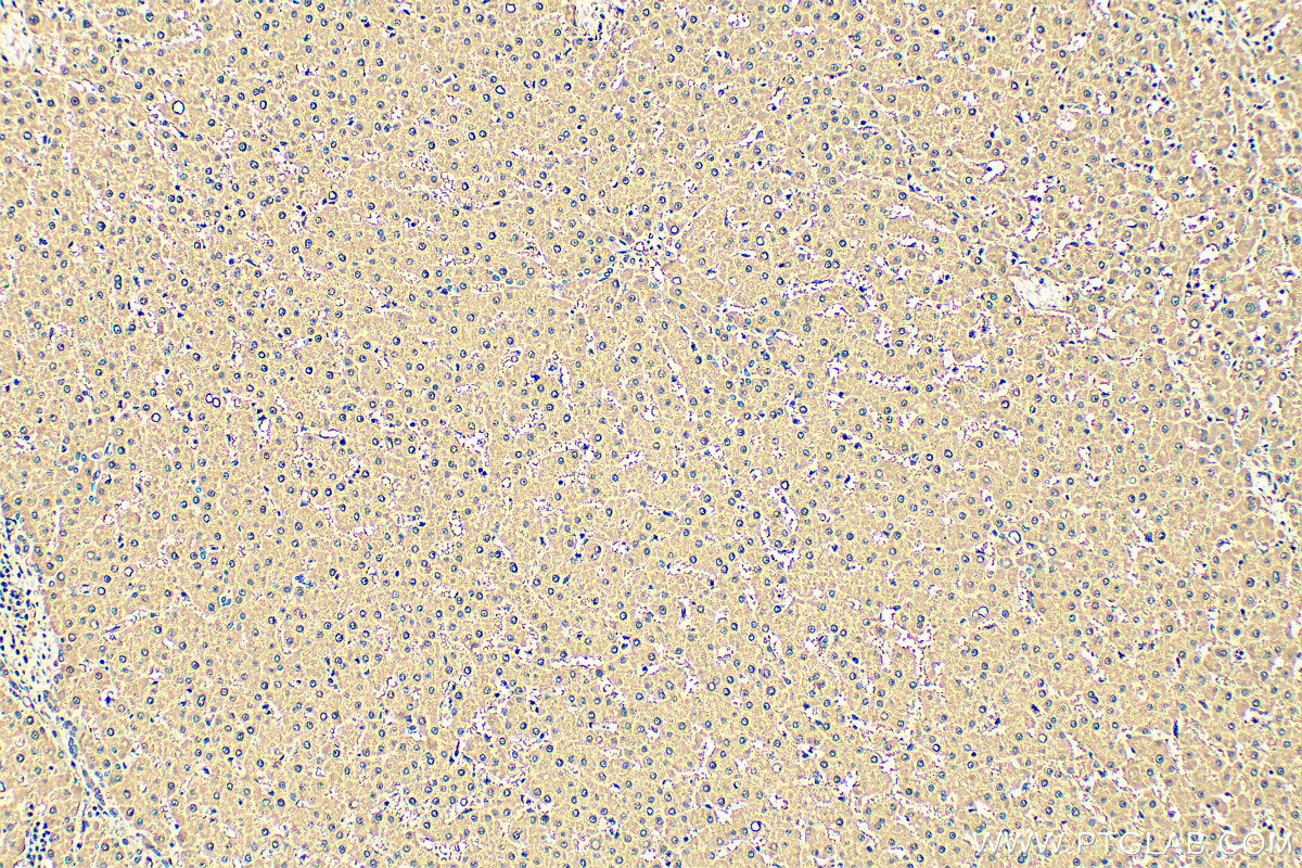 IHC staining of human liver using 83097-1-RR (same clone as 83097-1-PBS)