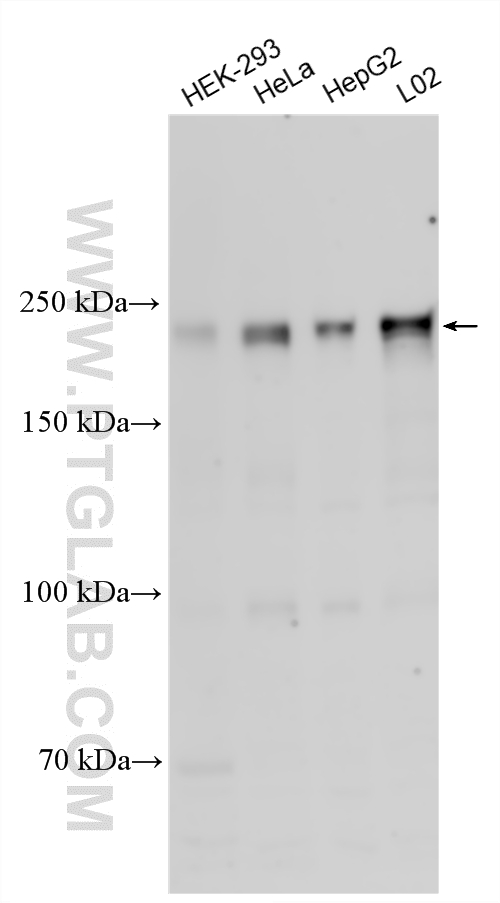 Various lysates were subjected to SDS PAGE followed by western blot with 23206-1-AP (Claspin antibody) at dilution of 1:4000 incubated at room temperature for 1.5 hours. WB analysis using 23206-1-AP