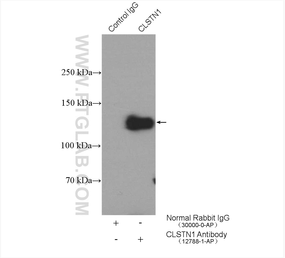 IP experiment of mouse brain using 12788-1-AP