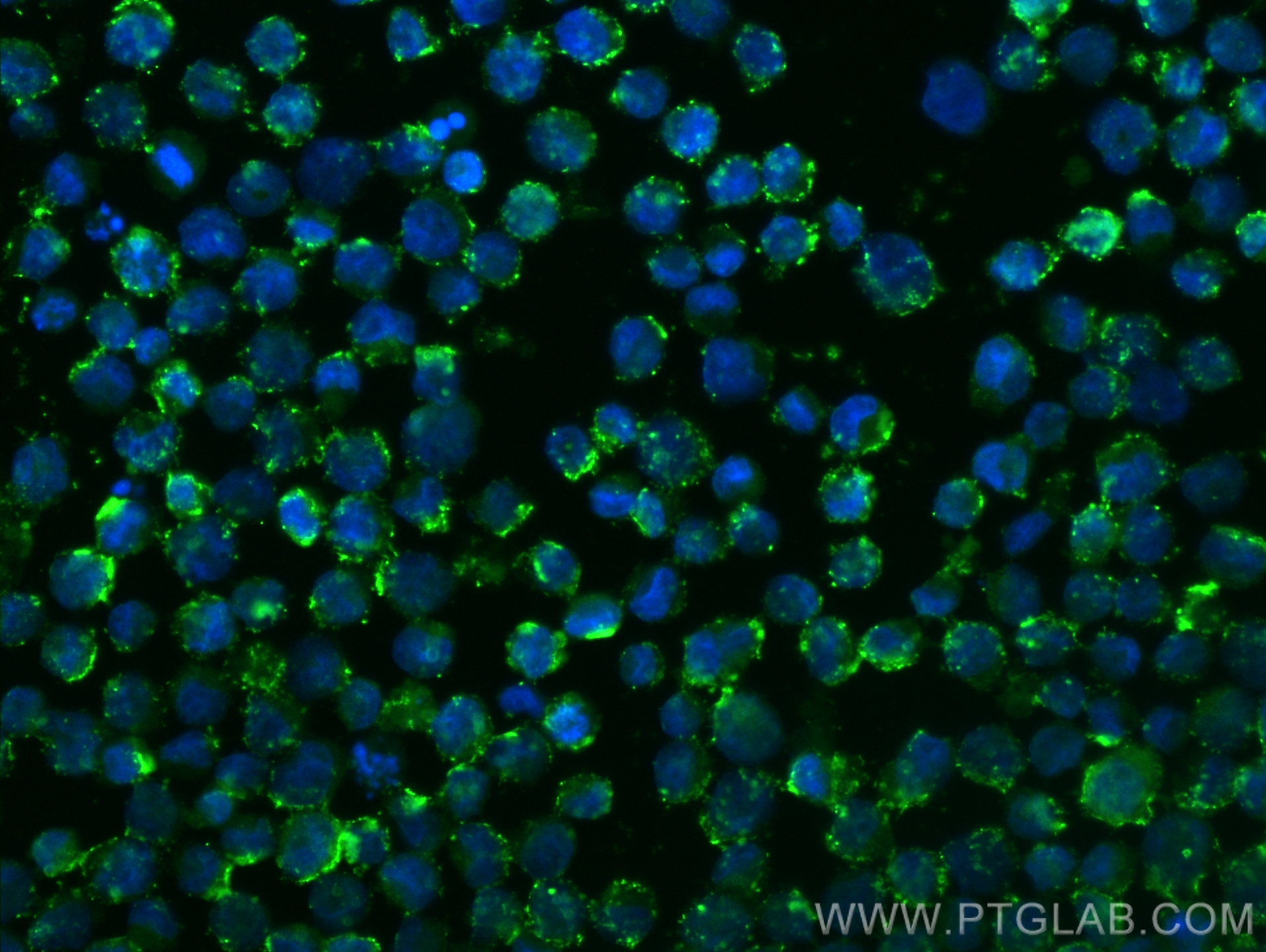 Immunofluorescent analysis of (4% PFA) fixed K-562 cells using CLSTN2 antibody (<a class='green' href='/productredirect?CatalogNo=21436-1-AP' target='_blank'>21436-1-AP</a>) at dilution of 1:200 and CoraLite®488-Conjugated Goat Anti-Rabbit IgG(H+L) (<a class='green' href='/productredirect?CatalogNo=SA00013-2' target='_blank'>SA00013-2</a>). This data was developed using the same antibody clone with 21436-1-PBS in a different storage buffer formulation. IF Staining of K-562 using 21436-1-AP (same clone as 21436-1-PBS)