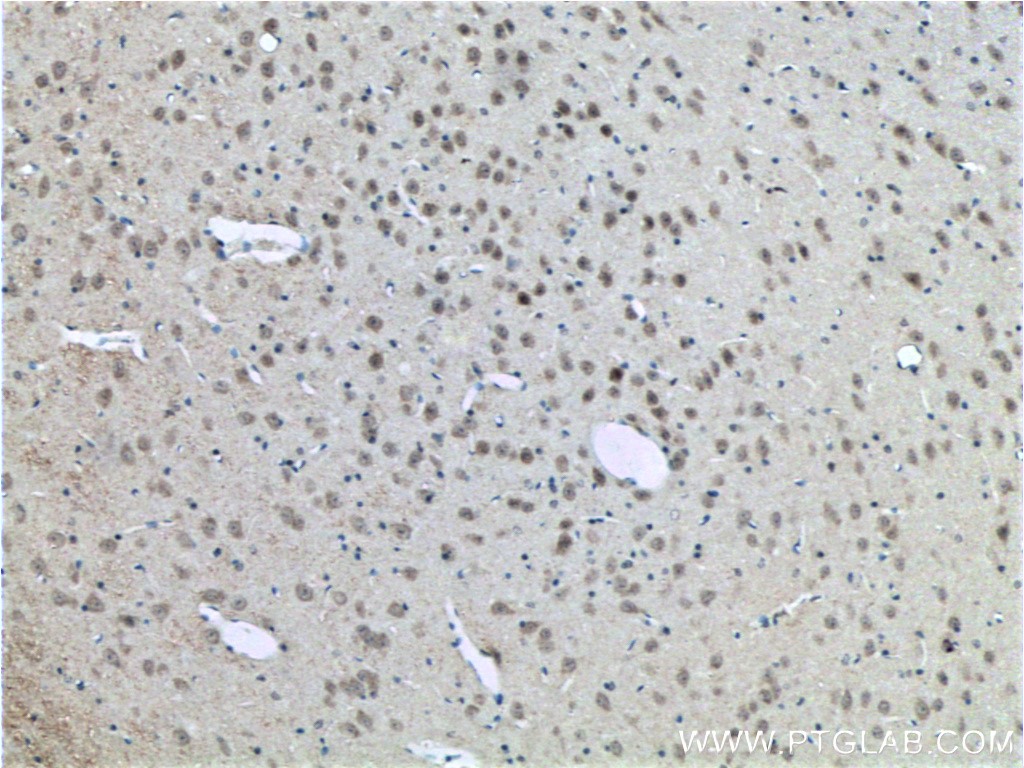 IHC staining of mouse brain using 21436-1-AP