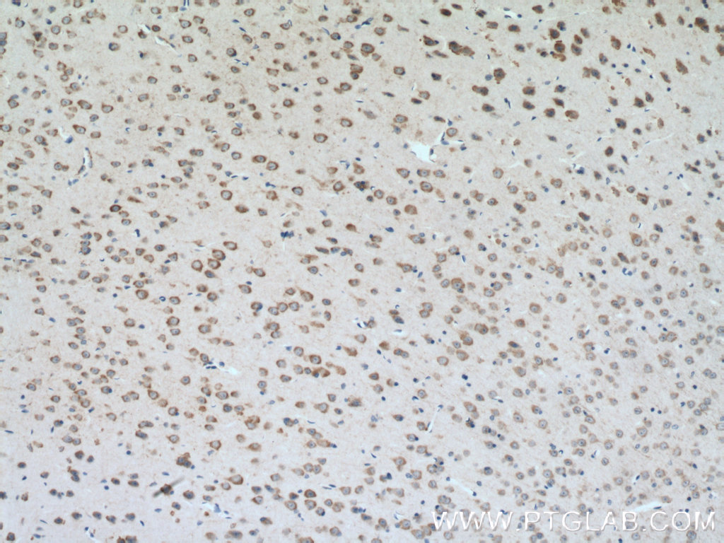 IHC staining of mouse brain using 13302-1-AP