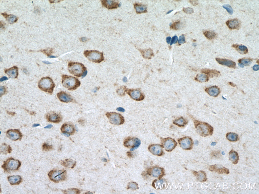 IHC staining of mouse brain using 13302-1-AP