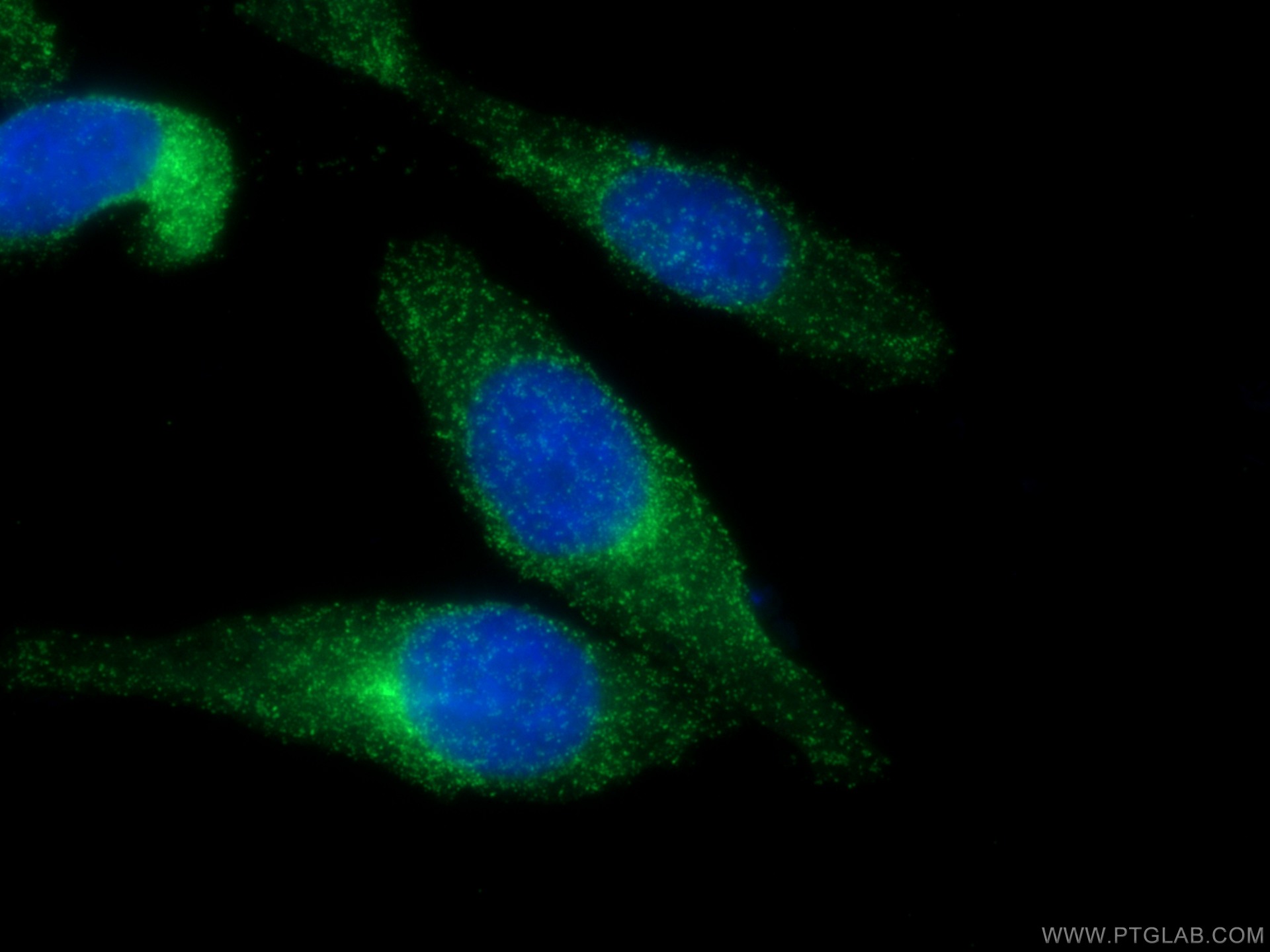 IF Staining of HepG2 using CL488-10852