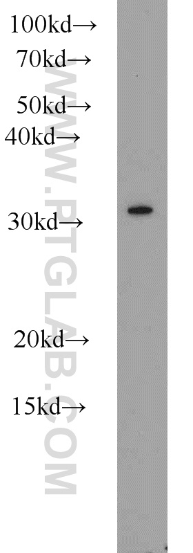 WB analysis of mouse thymus using 10455-1-AP