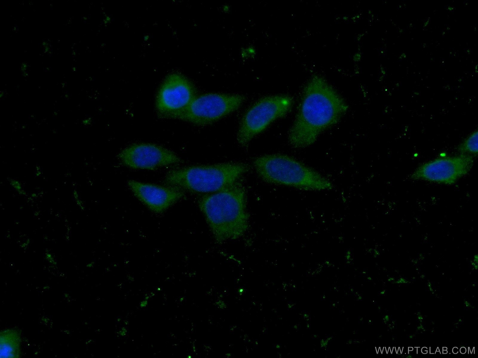 IF Staining of HeLa using 66270-1-Ig (same clone as 66270-1-PBS)