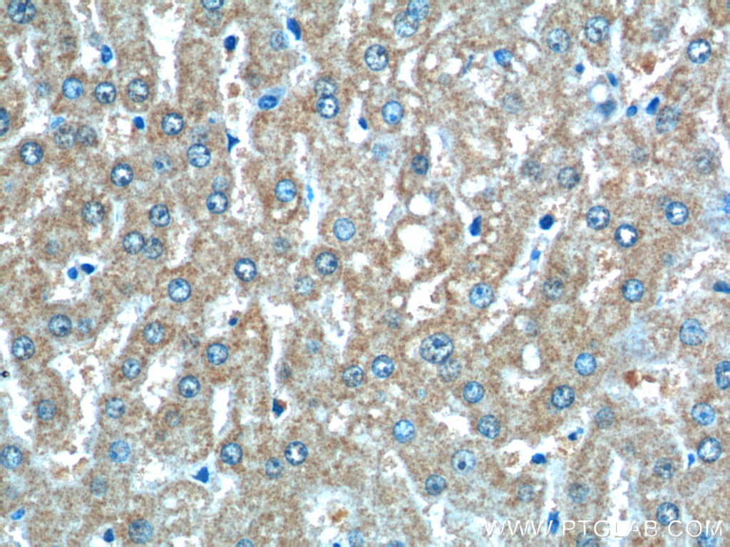 IHC staining of human liver using 66270-1-Ig (same clone as 66270-1-PBS)