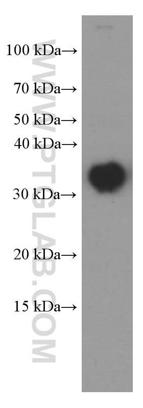 WB analysis of pig brain using 66270-1-Ig (same clone as 66270-1-PBS)