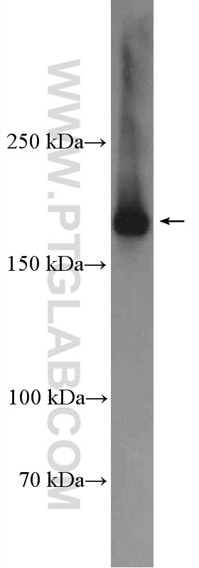 CLTC Polyclonal antibody