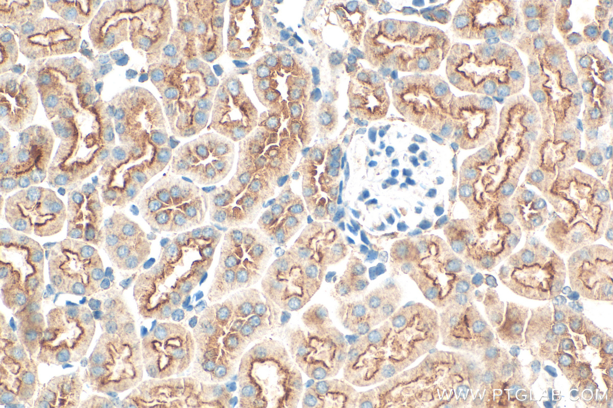 IHC staining of mouse kidney using 66487-1-Ig (same clone as 66487-1-PBS)