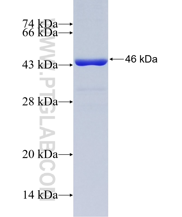 CLTC fusion protein Ag25040 SDS-PAGE