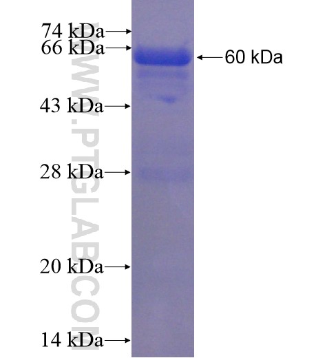 CLTC fusion protein Ag5470 SDS-PAGE