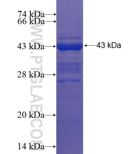 CLTC fusion protein Ag5568 SDS-PAGE CLTC fusion protein Ag5568 SDS-PAGE