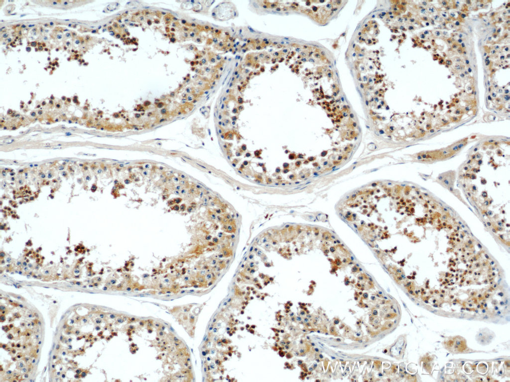 IHC staining of human testis using 22283-1-AP