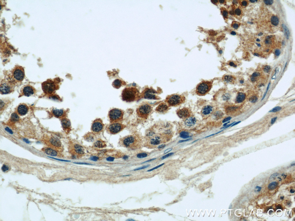 IHC staining of human testis using 22283-1-AP