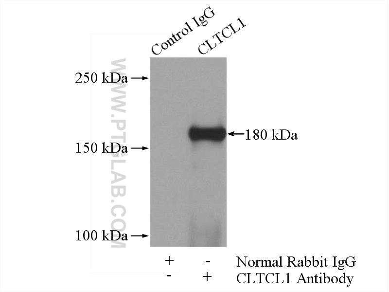 IP experiment of HeLa using 22283-1-AP