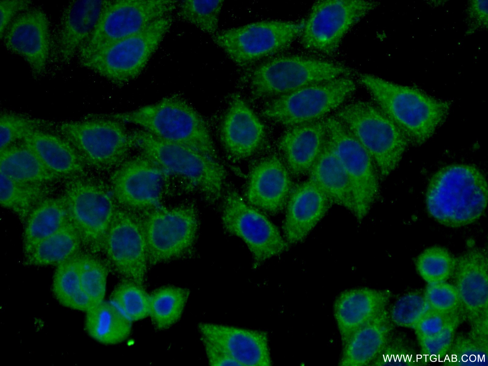 IF Staining of HeLa using 66274-1-Ig (same clone as 66274-1-PBS)