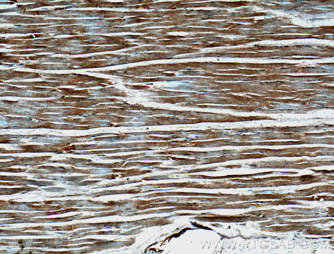 IHC staining of human skeletal muscle using 66274-1-Ig (same clone as 66274-1-PBS)