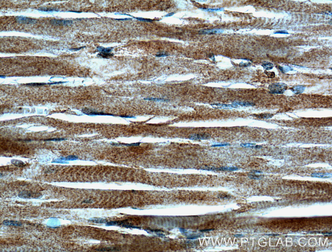 IHC staining of human skeletal muscle using 66274-1-Ig (same clone as 66274-1-PBS)