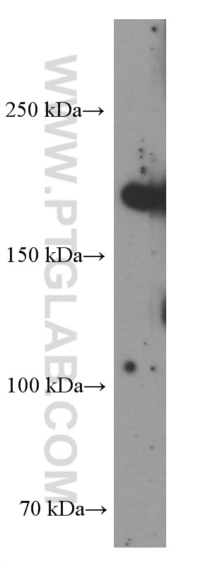 WB analysis of HeLa using 66274-1-Ig (same clone as 66274-1-PBS)