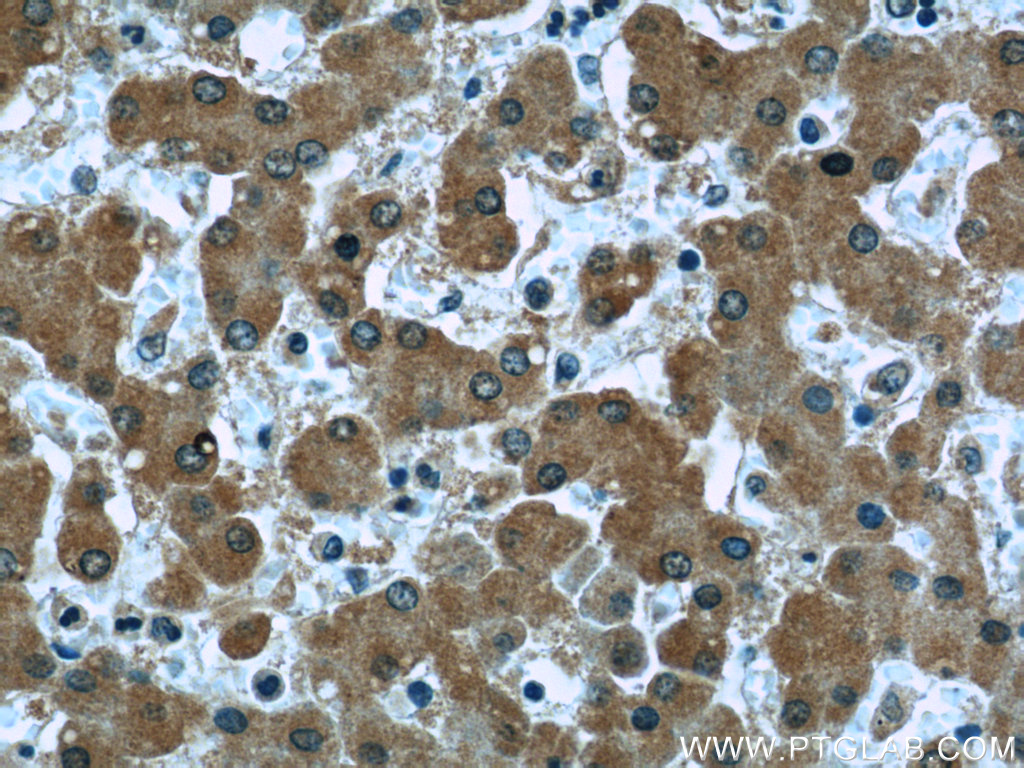IHC staining of human liver using 66109-1-Ig