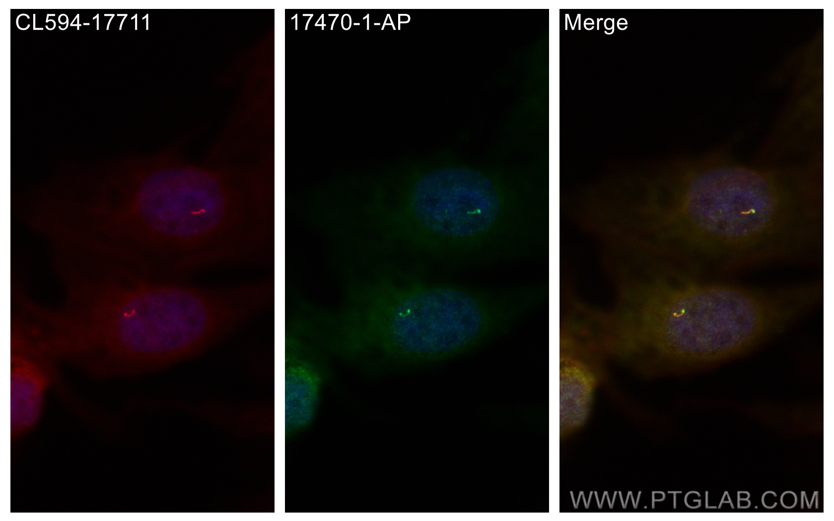 IF Staining of MDCK using 17470-1-AP