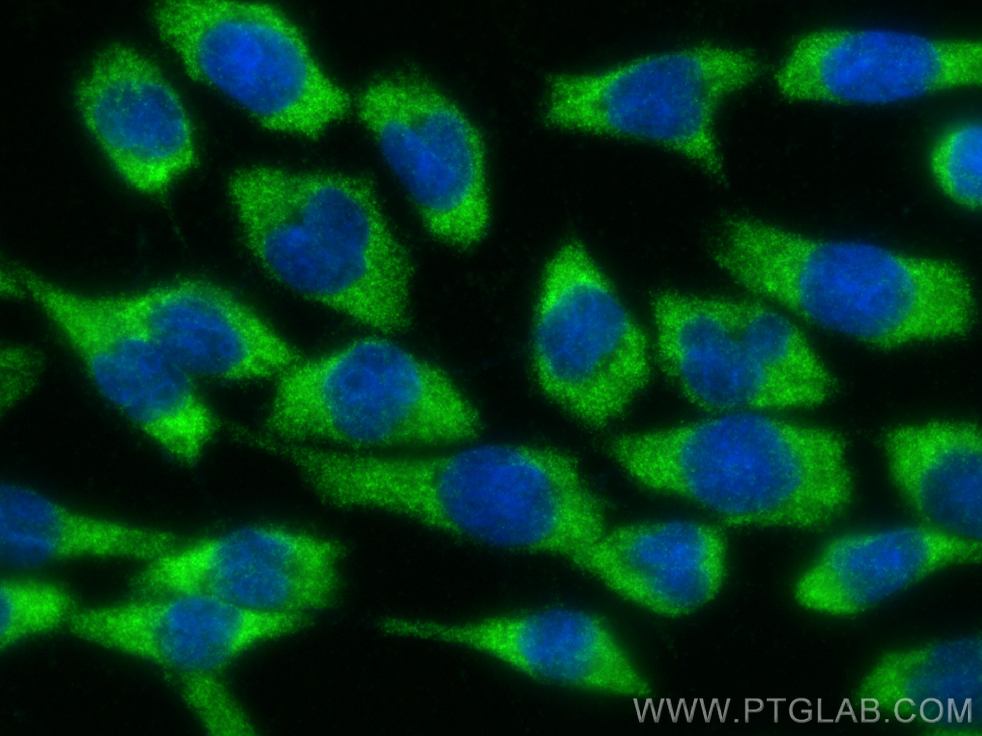 IF Staining of COS-7 using 30986-1-AP