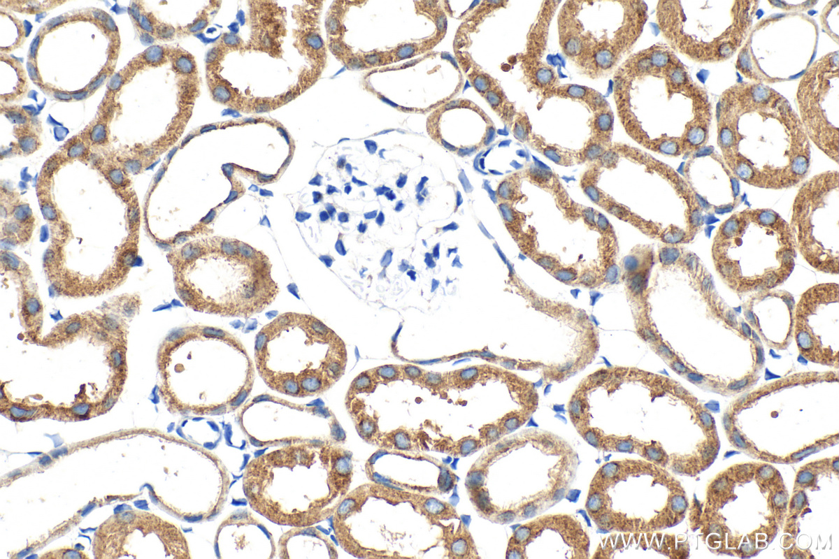 Immunohistochemical analysis of paraffin-embedded mouse kidney tissue slide using 30986-1-AP (CLUH antibody) at dilution of 1:500 (under 40x lens). Heat mediated antigen retrieval with Tris-EDTA buffer (pH 9.0). IHC staining of mouse kidney using 30986-1-AP