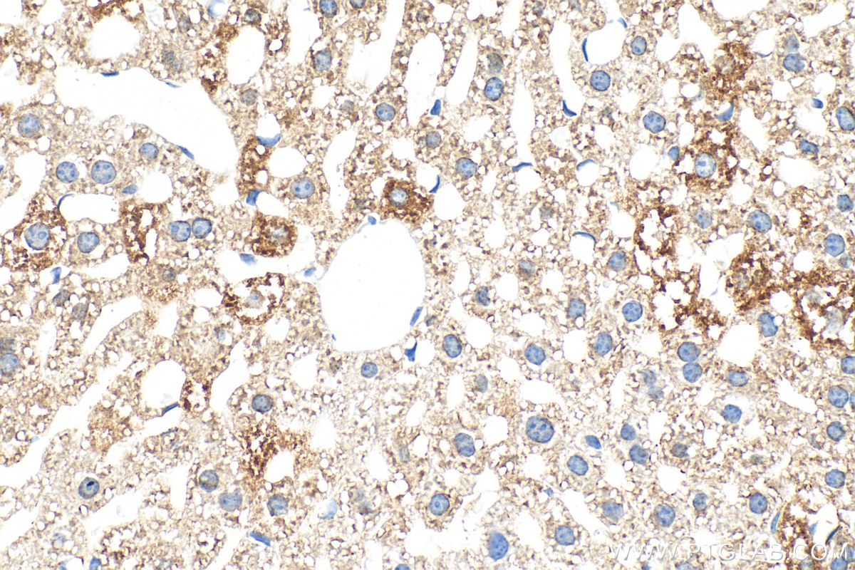 Immunohistochemical analysis of paraffin-embedded mouse liver tissue slide using 30986-1-AP (CLUH antibody) at dilution of 1:500 (under 40x lens). Heat mediated antigen retrieval with Tris-EDTA buffer (pH 9.0). IHC staining of mouse liver using 30986-1-AP