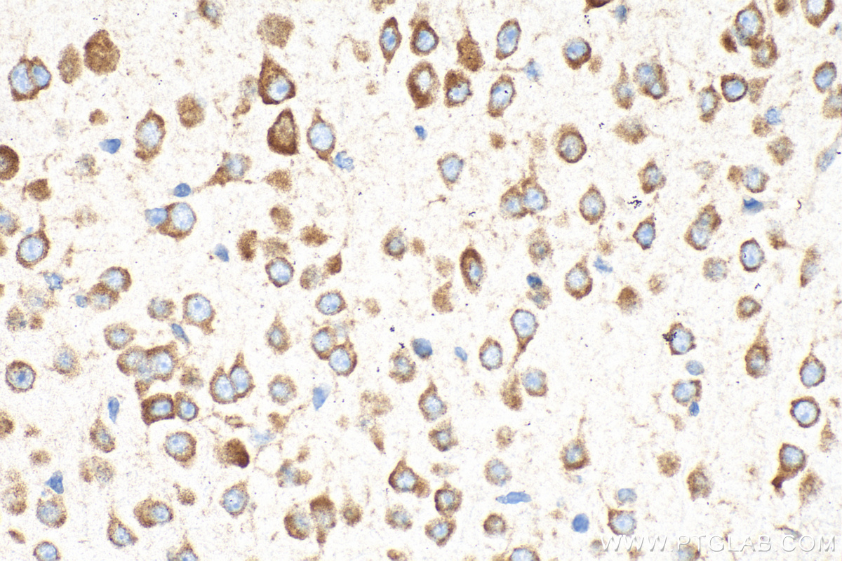 Immunohistochemical analysis of paraffin-embedded mouse brain tissue slide using 30986-1-AP (CLUH antibody) at dilution of 1:500 (under 40x lens). Heat mediated antigen retrieval with Tris-EDTA buffer (pH 9.0). IHC staining of mouse brain using 30986-1-AP