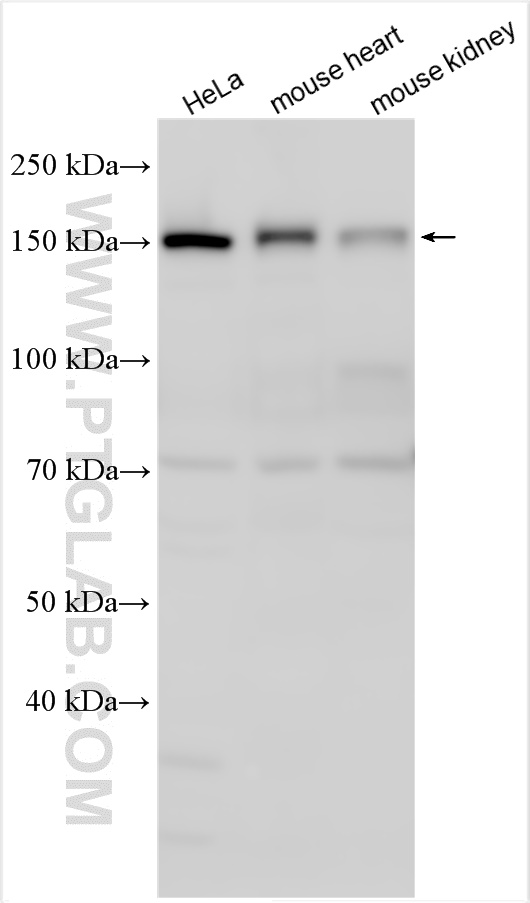 WB analysis using 30986-1-AP