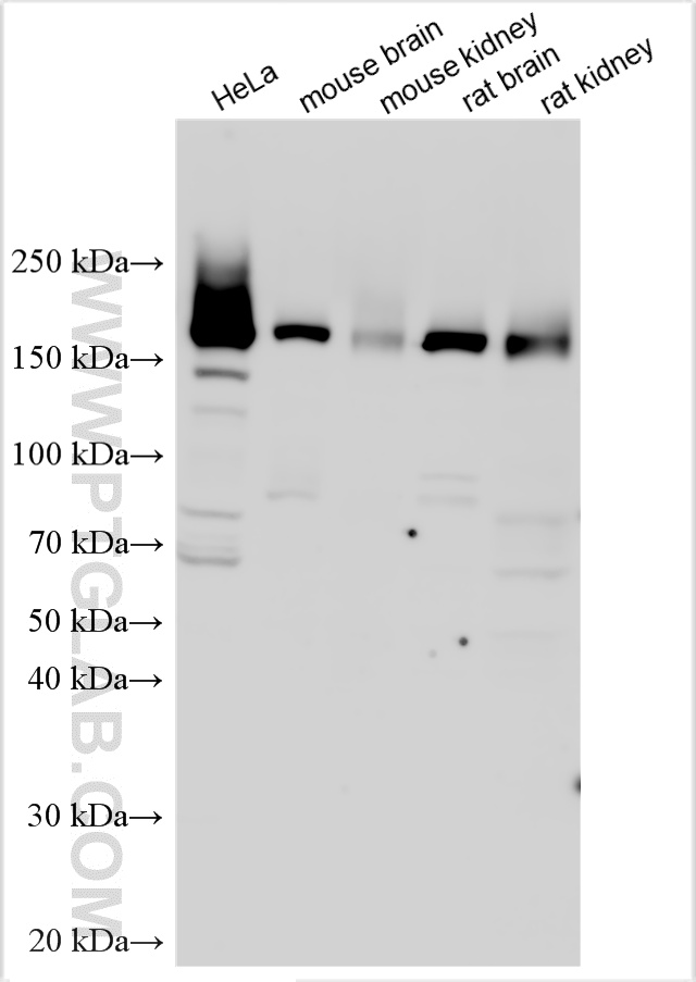 WB analysis using 30986-1-AP