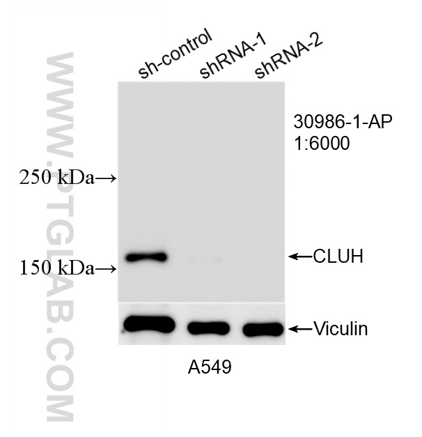 WB analysis of A549 using 30986-1-AP WB analysis of A549 using 30986-1-AP