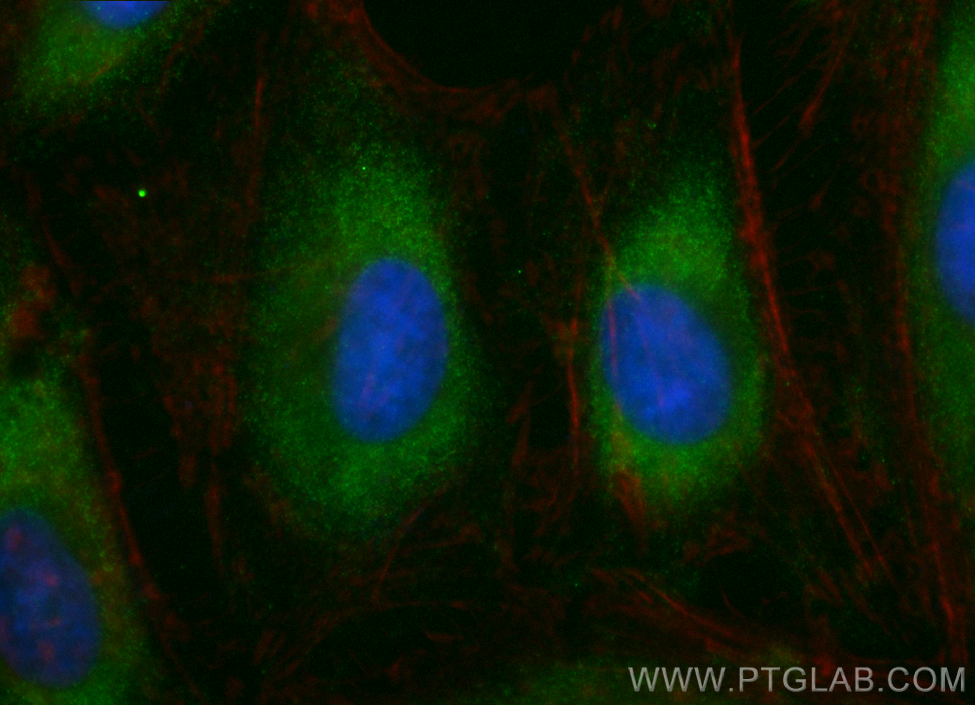 IF Staining of HeLa using CL488-84321-4