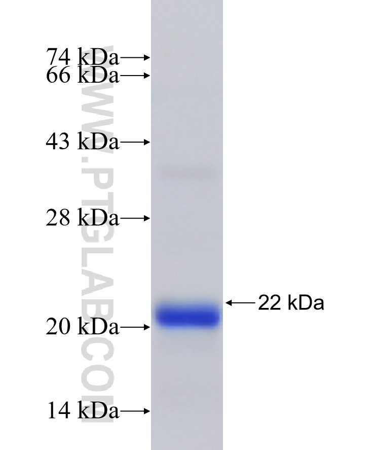 CLUL1 fusion protein Ag26606 SDS-PAGE CLUL1 fusion protein Ag26606 SDS-PAGE