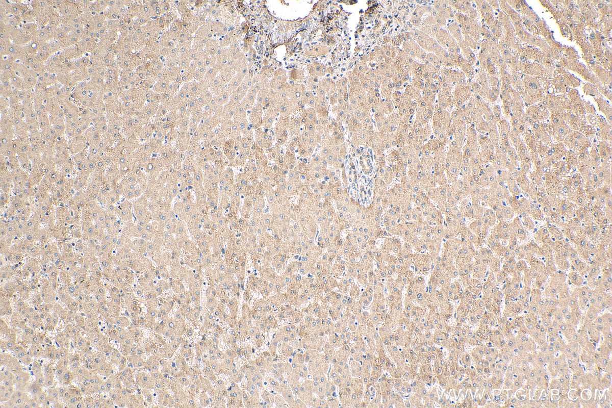IHC staining of human liver using 17314-1-AP