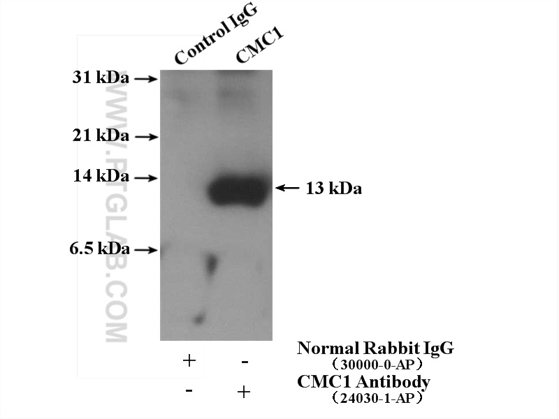 IP experiment of K-562 using 24030-1-AP