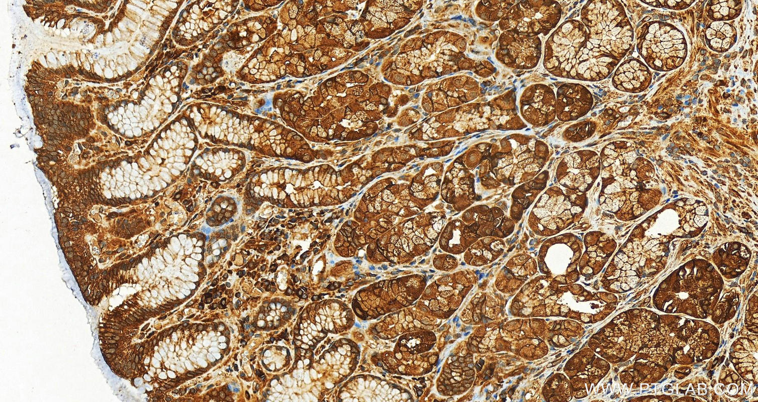IHC staining of human stomach using 12851-1-AP