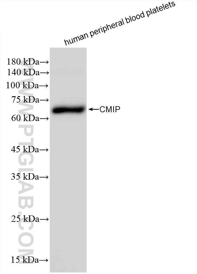 WB analysis of human peripheral blood platelets using 83381-1-RR