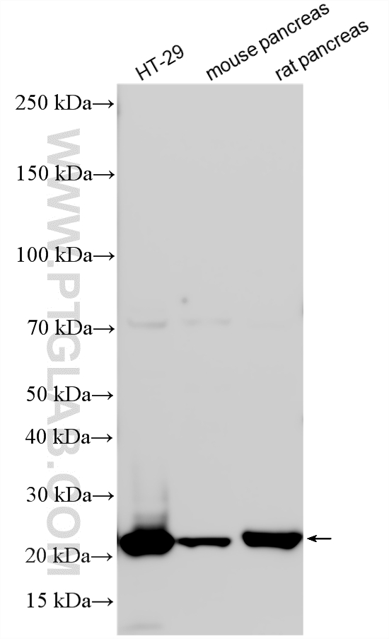 WB analysis using 11360-1-AP WB analysis using 11360-1-AP