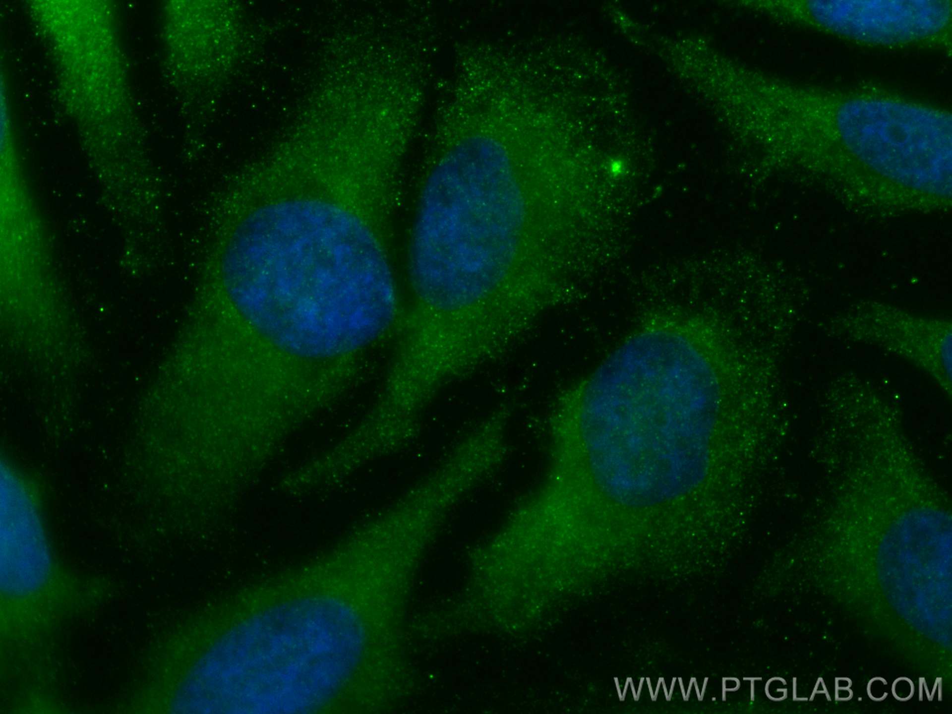 IF Staining of HeLa using 67519-1-Ig (same clone as 67519-1-PBS)