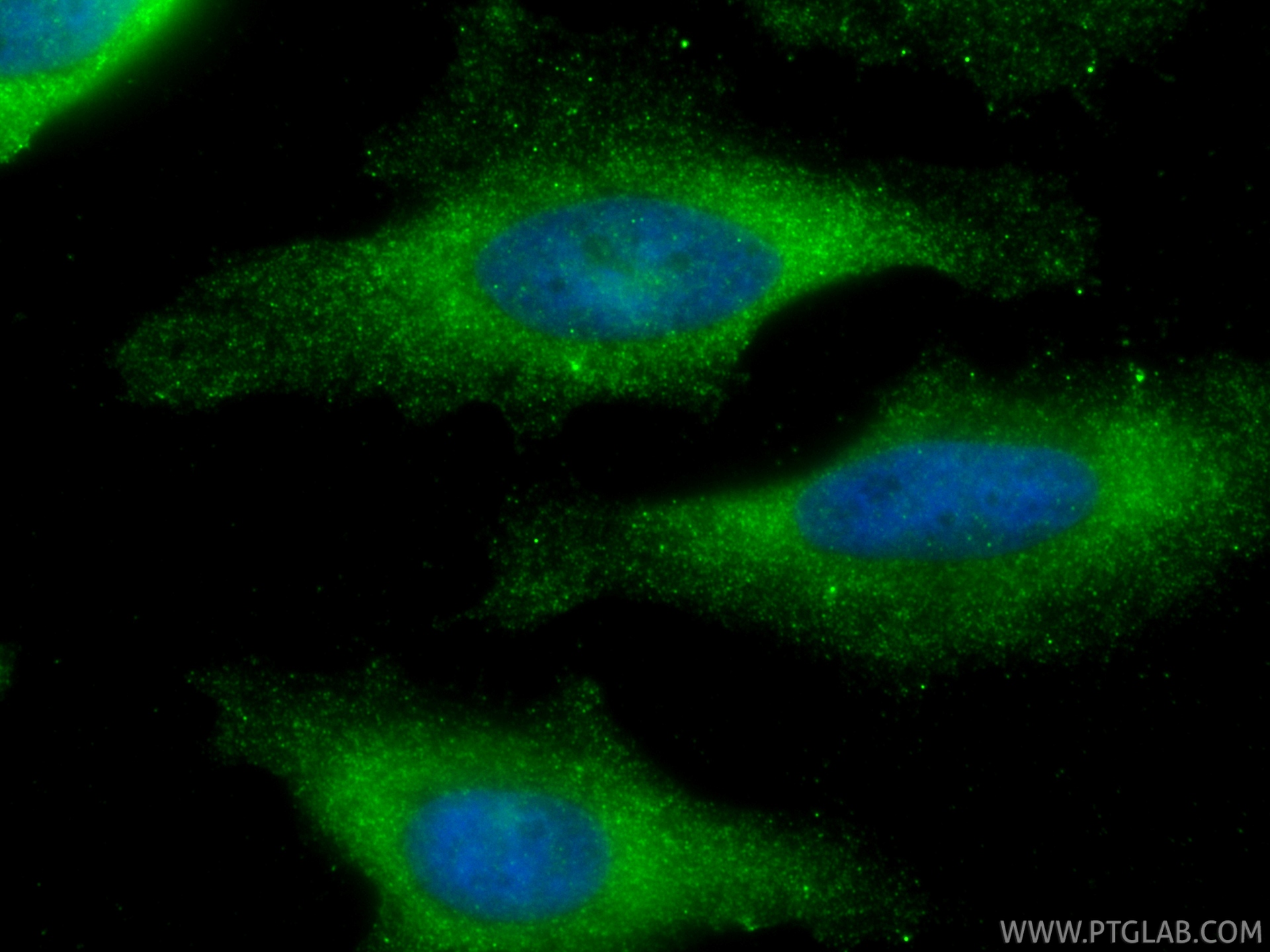 IF Staining of HeLa using 67519-1-Ig IF Staining of HeLa using 67519-1-Ig
