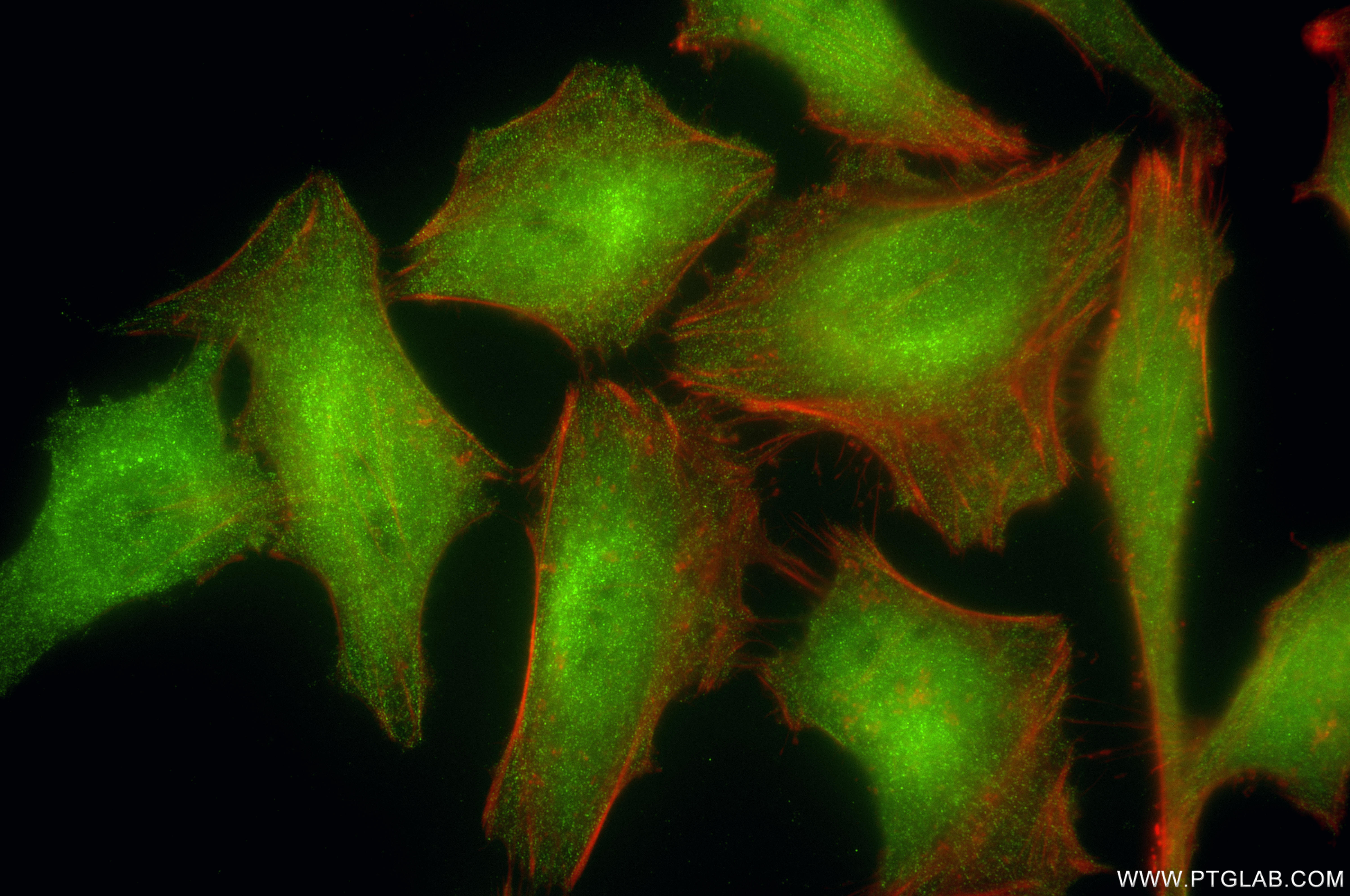 IF Staining of HeLa using 86475-1-RR (same clone as 86475-1-PBS)