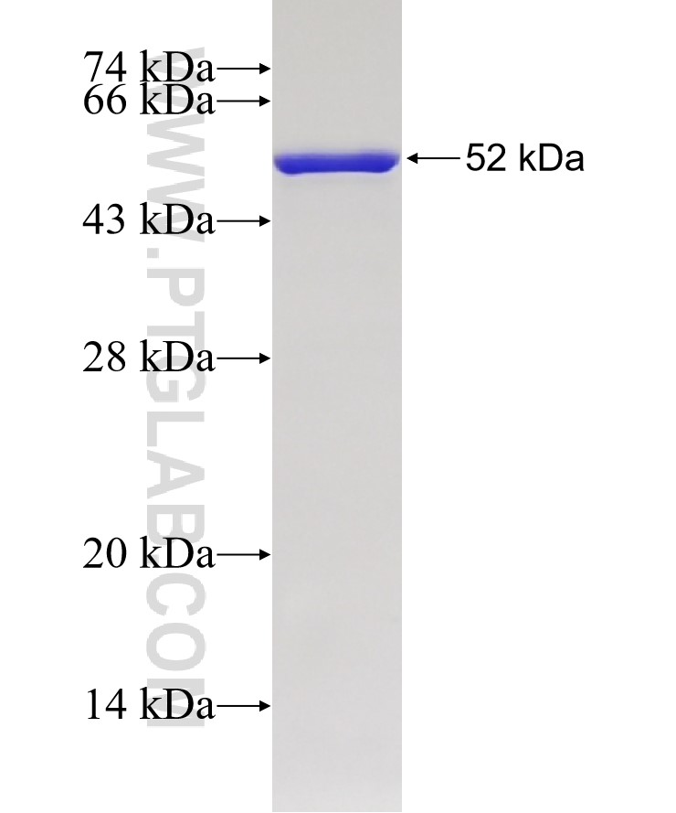 CMPK1 fusion protein Ag1920 SDS-PAGE