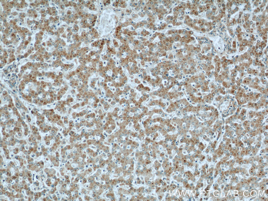 IHC staining of human liver using 15039-1-AP
