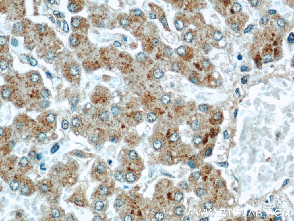 IHC staining of human liver using 15039-1-AP