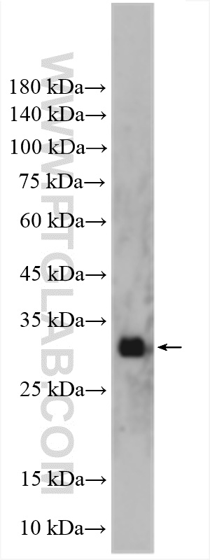 WB analysis of mouse bladder using 15039-1-AP