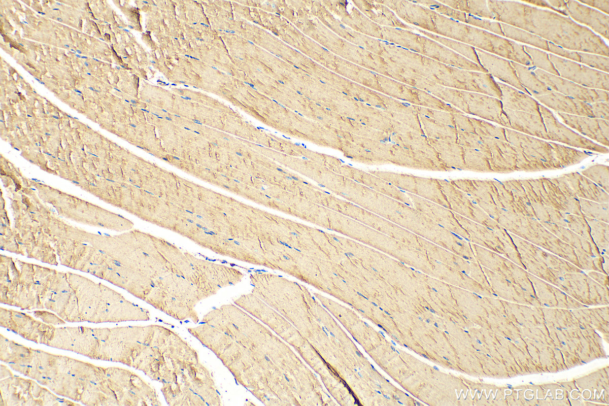 IHC staining of mouse skeletal muscle using 31176-1-AP