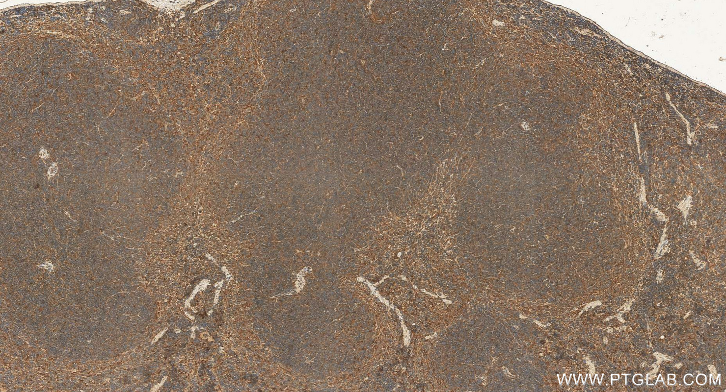 IHC staining of mouse spleen using 14717-1-AP